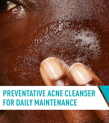 Acne Control Cleanser